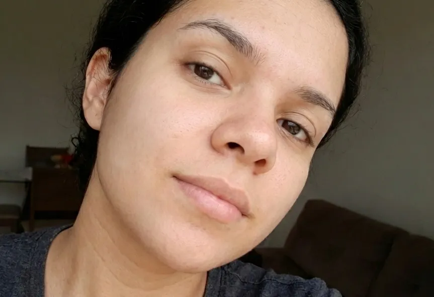 Tatiane L. — depois